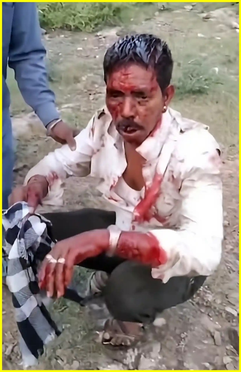 उदयपुर के उमरड़ा खेड़ा में पैंथर ने पांच ग्रामीणों पर किया हमला